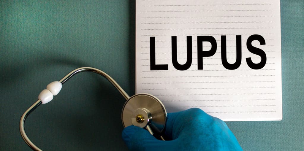 lupus disability